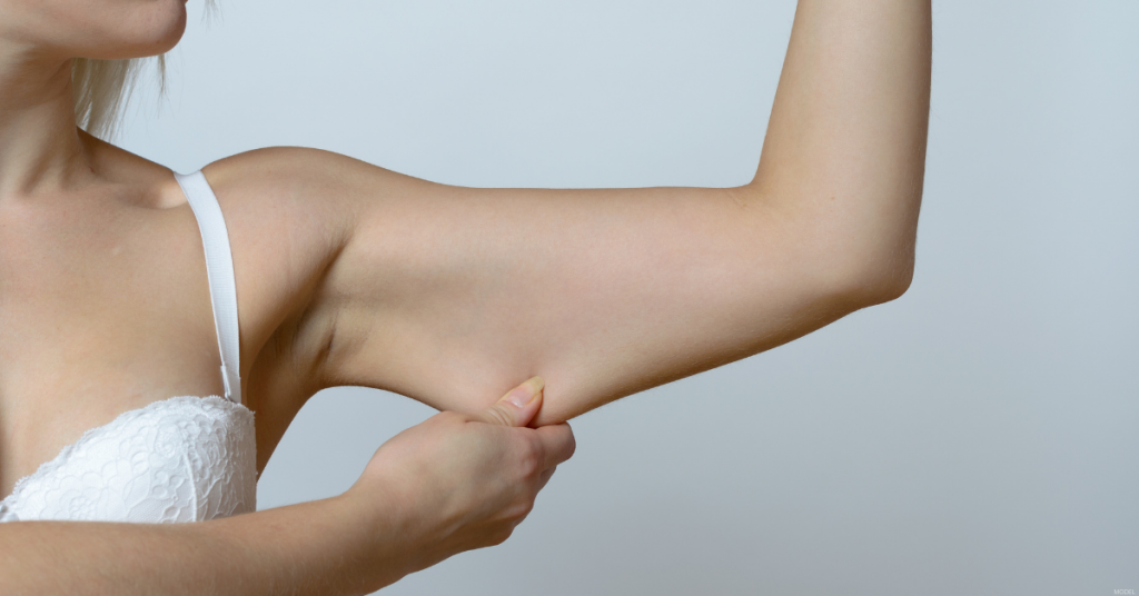 A woman stretches her skin.