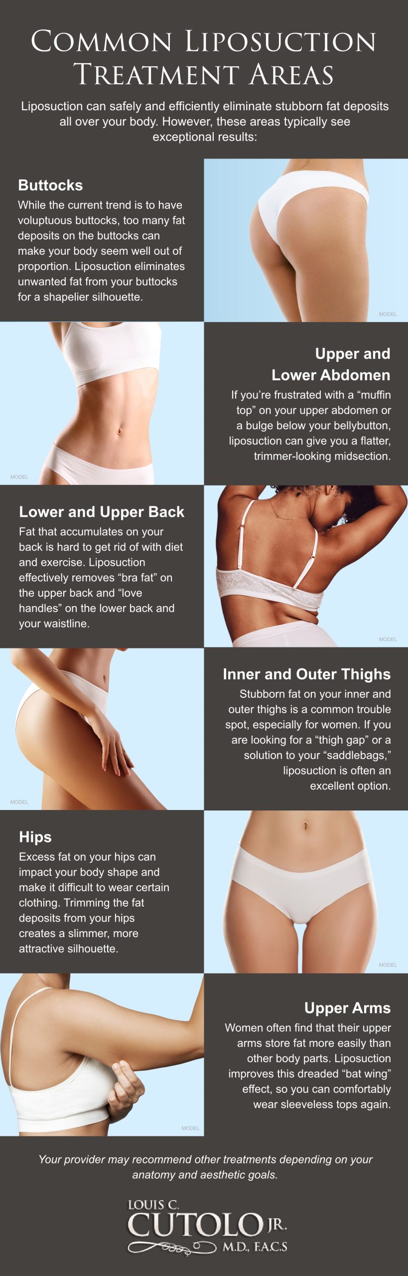 Infographic of common liposuction treatment areas including: buttocks, upper and lower abdomen, lower and upper back, inner and outer thighs, hips, and upper arms. (MODELS)