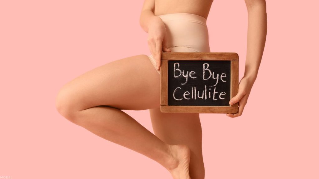 Woman holding a chalkboard with the words say bye bye cellulite (model)